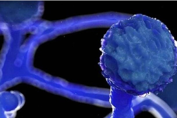 Black Fungus | സംസ്ഥാനത്ത്  ബ്ലാക്ക് ഫംഗസ് ബാധിച്ച് മരണം