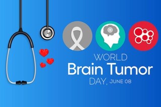 (Representational Photo: Shutterstock)