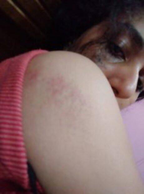  മര്‍ദനത്തിലേറ്റ പരുക്കിന്റെ ചിത്രങ്ങളും ബന്ധുക്കള്‍ക്ക് കൈമാറി. ഇതിനു പിന്നാലെ ഇന്ന് പുലര്‍ച്ചെയാണ് വിസ്മയ വീടിനുളളില്‍ തൂങ്ങിമരിച്ച വിവരം ബന്ധുക്കള്‍ അറിഞ്ഞത്.