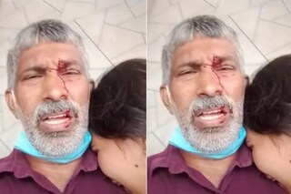 പരിക്കേറ്റ സലീമും മകളും പരിക്കേറ്റ സലീമും മകളും