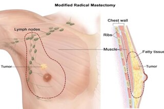 Image by News18 Hindi.
 Image by News18 Hindi.