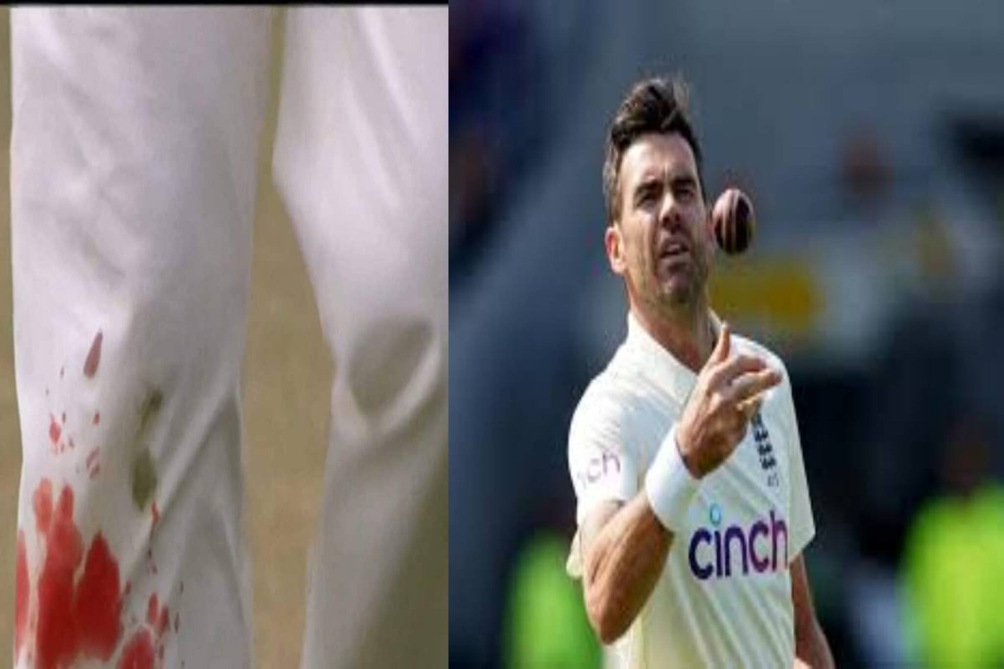 വയസ്സ് 39! ചോരയൊലിക്കുന്ന കാലുമായി ബൗളിംഗ് തുടര്‍ന്ന് ആന്‍ഡേഴ്‌സണ്‍; വീഡിയോ