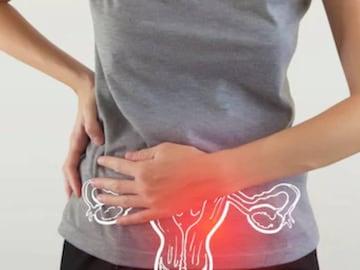 Ovarian-Cancer