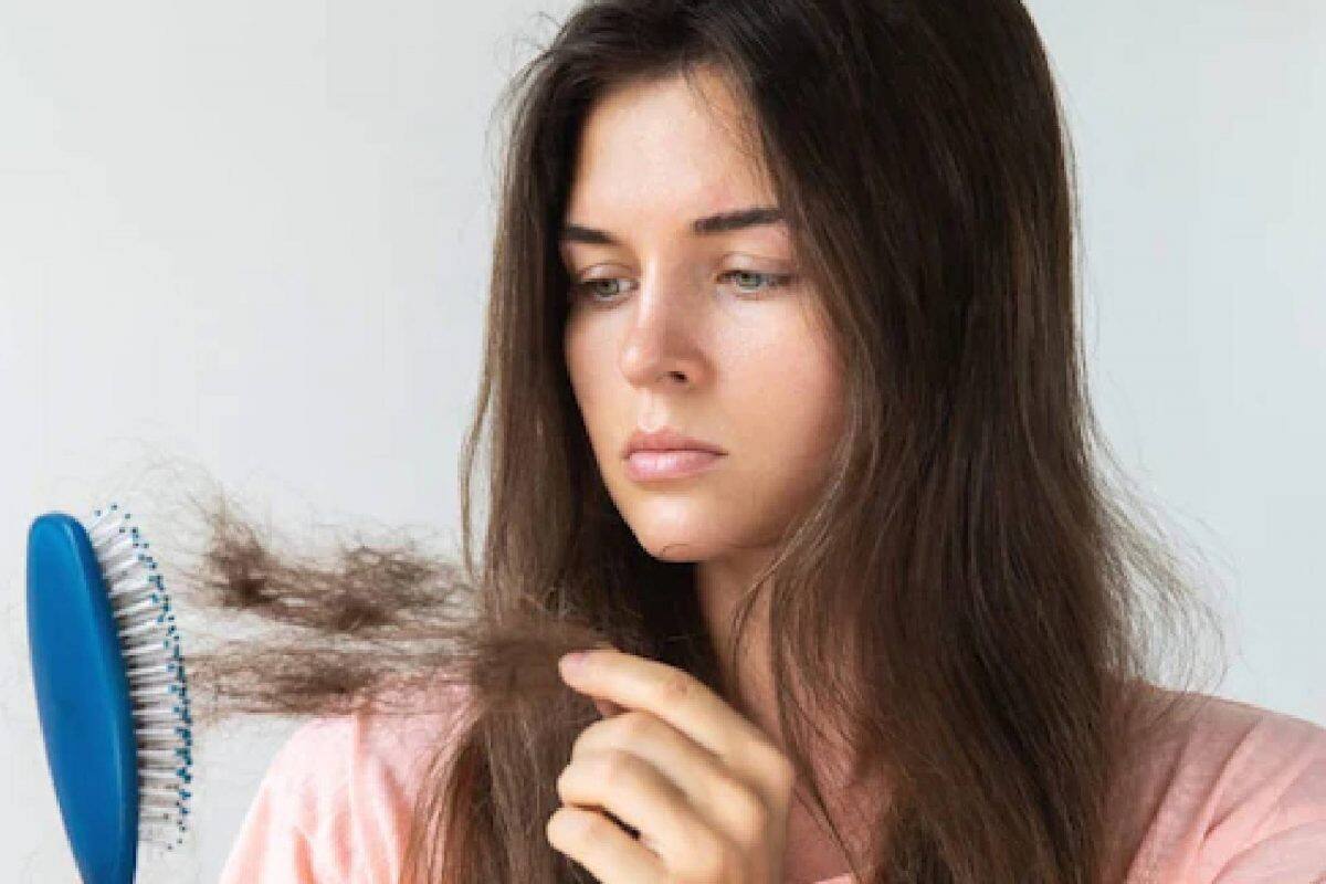 Discover more than 156 hair loss treatment malayalam POPPY