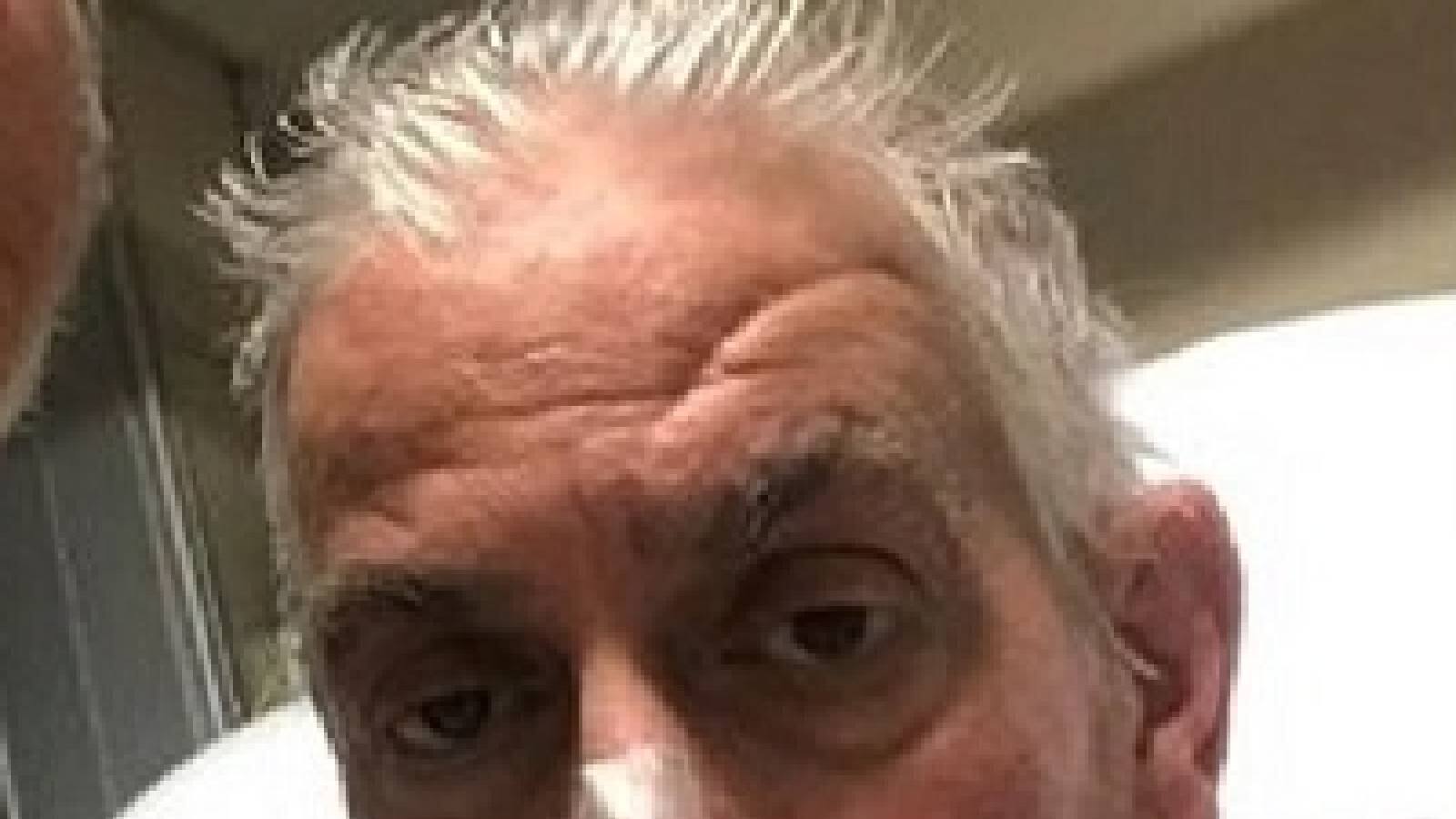 Pig heart Transplantation The first person in the world to receive a pig's heart has died