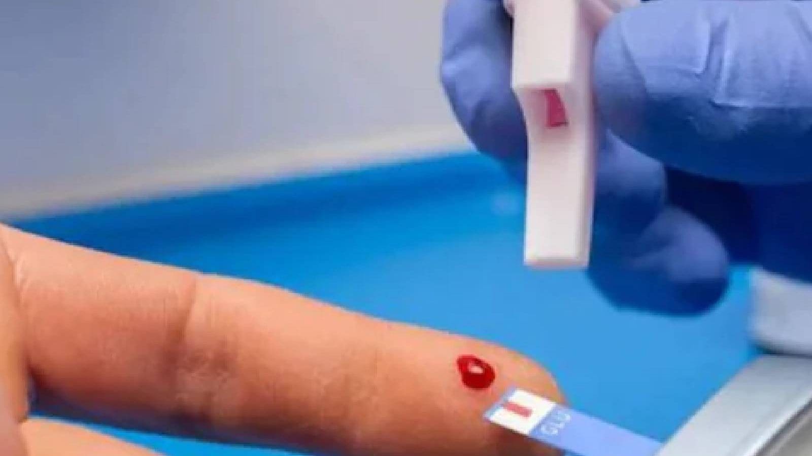 blood-test