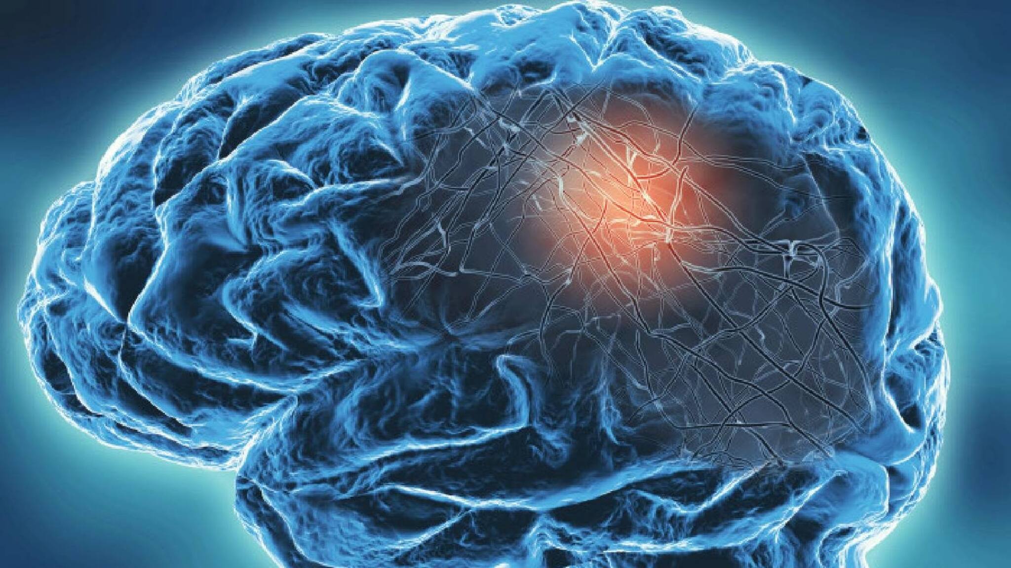 COVID-19 ബാധിച്ചവരിൽ വൈജ്ഞാനിക വൈകല്യം; 20 വയസ് കൂടുന്നതിന് തുല്യം; ഞെട്ടിച്ച് പഠനം