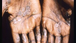 (Image: Reuters File) (Image: Reuters File)