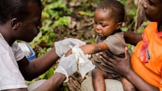 കുരങ്ങുപനി ബാധിച്ച കുട്ടി ചികിത്സ സ്വീകരിക്കുന്നു (AFP) കുരങ്ങുപനി ബാധിച്ച കുട്ടി ചികിത്സ സ്വീകരിക്കുന്നു (AFP)