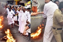 കോലം കത്തിയ്ക്കുന്നതിനിടെ  മുണ്ടിന് തീപിടിച്ച യൂത്ത് കോൺഗ്രസ് നേതാവ് പൊള്ളലേറ്റ് ചികിത്സയിൽ