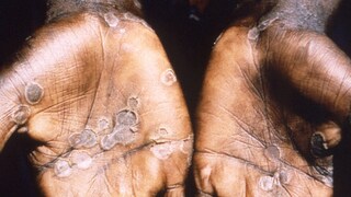 ഫോട്ടോ- റോയിട്ടേഴ്സ് ഫോട്ടോ- റോയിട്ടേഴ്സ്