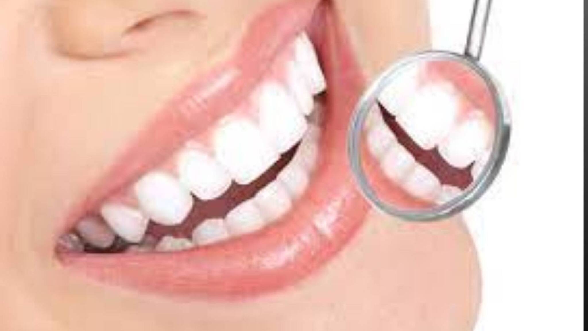 Oral Hygiene Day വായ വൃത്തിയാക്കാനും ഒരു ദിവസം എന്നത് ഒരു തമാശയായി തോന്നുന്നുണ്ടോ?