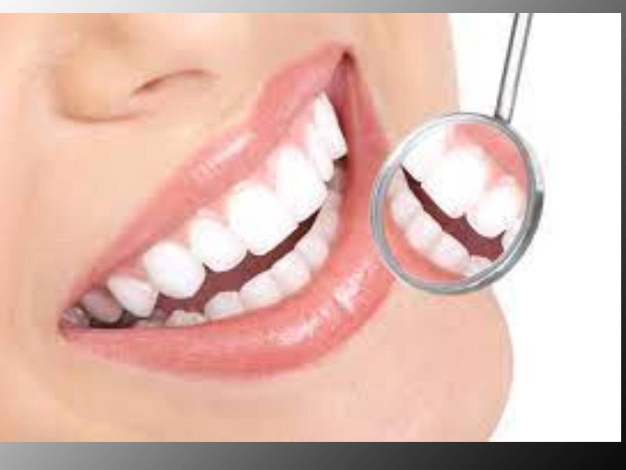 Oral Hygiene Day വായ വൃത്തിയാക്കാനും ഒരു ദിവസം എന്നത് ഒരു തമാശയായി തോന്നുന്നുണ്ടോ?