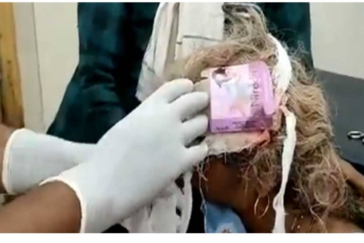 'രക്തസ്രാവം തടയാൻ കോട്ടണൊപ്പം കോണ്ടത്തിന്റെ പാക്കറ്റ്' ; തലയിലെ കെട്ടഴിച്ച ഡോക്ടര്‍ ഞെട്ടി