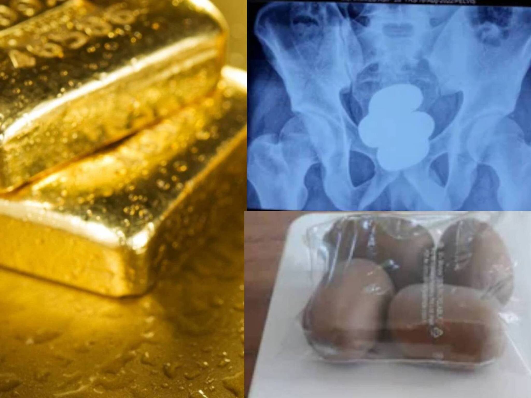 Gold Smuggling | സ്വർണം മലദ്വാരത്തിൽ വരെ വെച്ച് കടത്തുന്നത് എന്തുകൊണ്ട്?