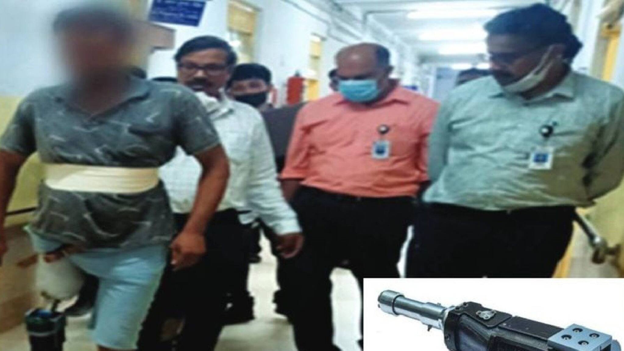 മുട്ടിന് മുകളിൽ കാൽ നഷ്ടപ്പെട്ടവർക്ക് മൈക്രോചിപ്പ് ഘടിപ്പിച്ച യന്ത്രക്കാലുമായി ഐ.എസ്.ആര്‍.ഒ