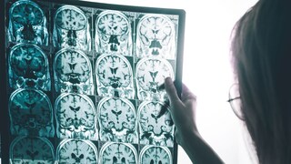  (Representative image: Shutterstock)