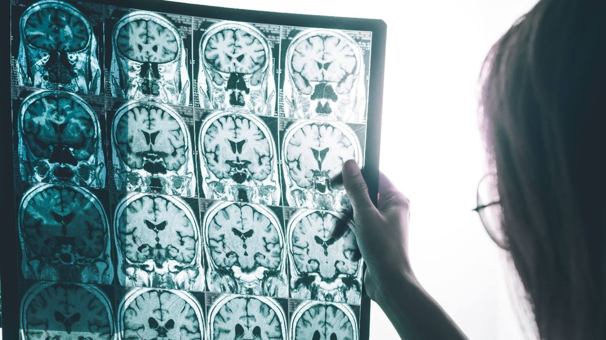 World Alzheimer's Day | മറന്നു  പോയോ? ഇന്ന് ലോക അൽഷിമേഴ്‌സ് ദിനം