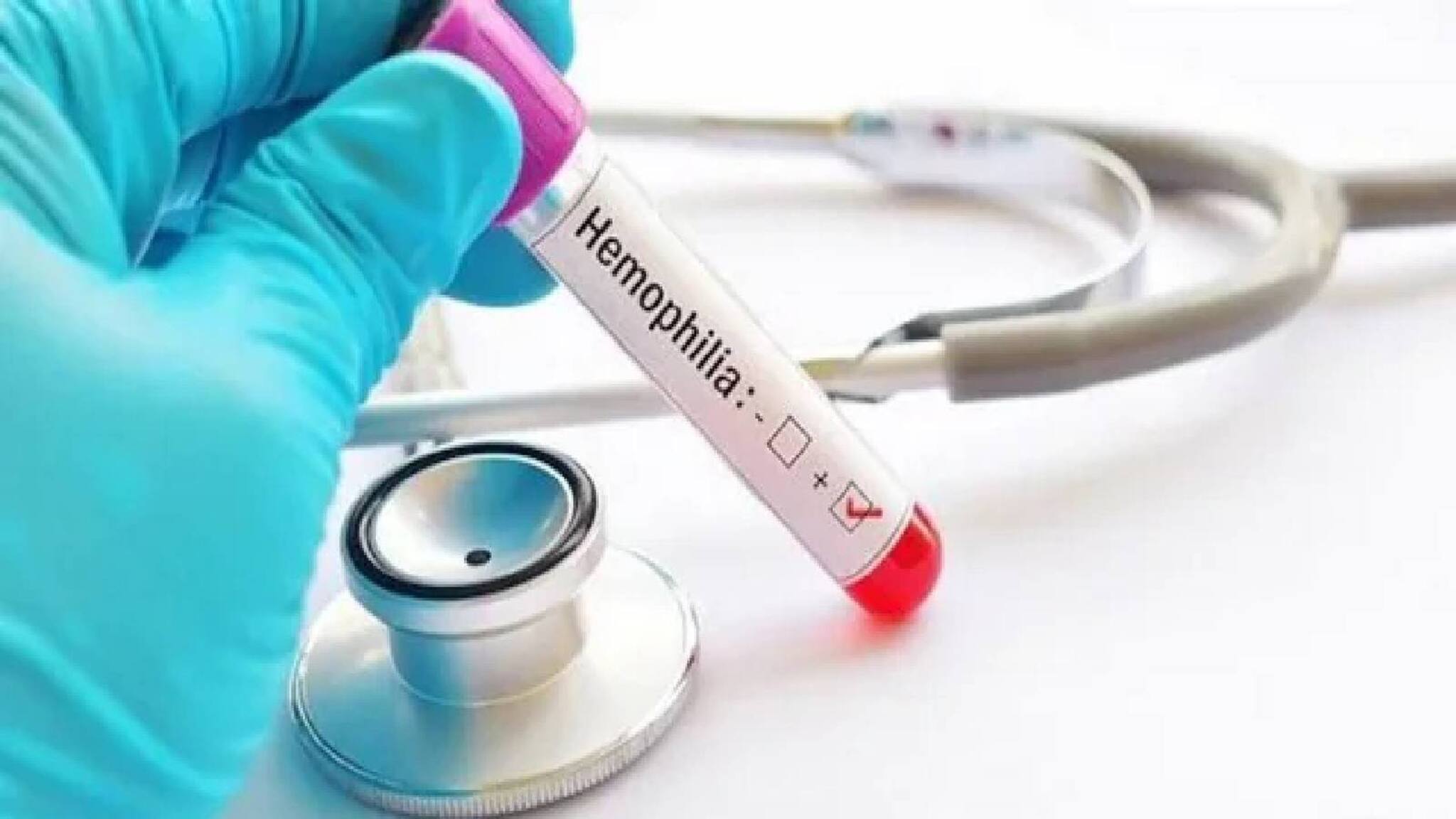 ഒരു ഡോസിന് 28.6 കോടി രൂപ; ഹിമോഫീലിയയ്ക്കുള്ള ഹെംജെനിക്‌സ് മരുന്നിന് ഫുഡ് ആന്‍ഡ് ഡ്രഗ് അഡ്മിനിസ്‌ട്രേഷന്‍ അംഗീകാരം