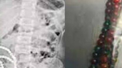 പ്രതീകാത്മകത ചിത്രം പ്രതീകാത്മകത ചിത്രം