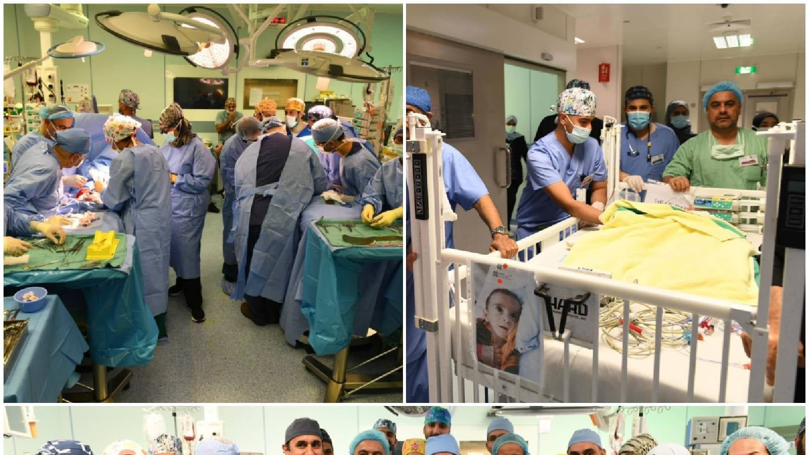 Iraqi Conjoined Twins Have Been Successfully Separated After Eleven Hours Of Surgery Timenews