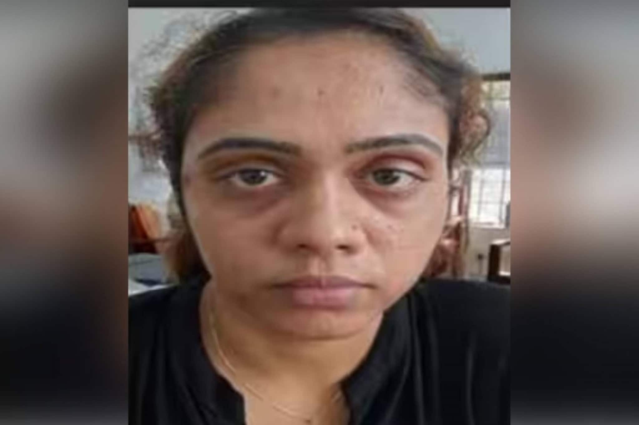 ഹോംസ്റ്റേ ഉടമയെ ഹണിട്രാപ്പിൽപ്പെടുത്തി പത്ത് ലക്ഷം രൂപ ആവശ്യപ്പെട്ട് മർദിച്ച യുവതി അറസ്റ്റില്‍