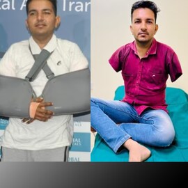 ഇരുകൈകളും മാറ്റിവെക്കുന്ന ഏഷ്യയിലെ ആദ്യ ശസ്ത്രക്രിയ ഇന്ത്യയിൽ; 16 മണിക്കൂർ നീണ്ട ശസ്ത്രക്രിയ വിജയമെന്ന് ഡോക്ടർമാർ ഇരുകൈകളും മാറ്റിവെക്കുന്ന ഏഷ്യയിലെ ആദ്യ ശസ്ത്രക്രിയ ഇന്ത്യയിൽ; 16 മണിക്കൂർ നീണ്ട ശസ്ത്രക്രിയ വിജയമെന്ന് ഡോക്ടർമാർ