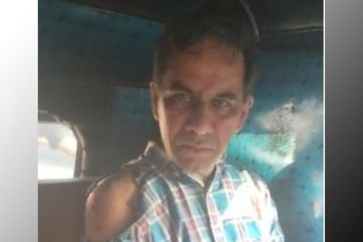 യുവതിക്കുനേരെ ആസിഡാക്രമണം നടത്തിയത് രണ്ടാം ഭർത്താവെന്ന് മൊഴി; പ്രകോപനം ആദ്യ ഭർത്താവിനൊപ്പം താമസിച്ചതിന്‍റെ വൈരാഗ്യം