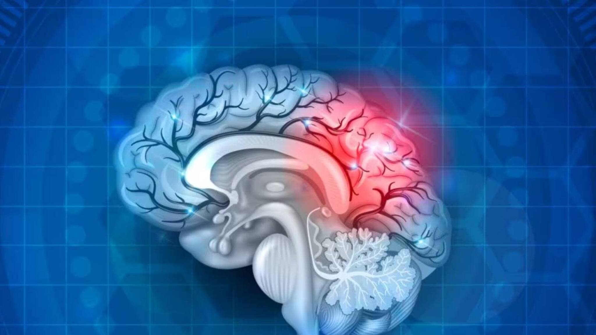 Health Tips | ബ്രെയിൻ സ്ട്രോക്ക്: ലക്ഷണങ്ങൾ എന്തൊക്കെ? ചികിത്സ എങ്ങനെ?