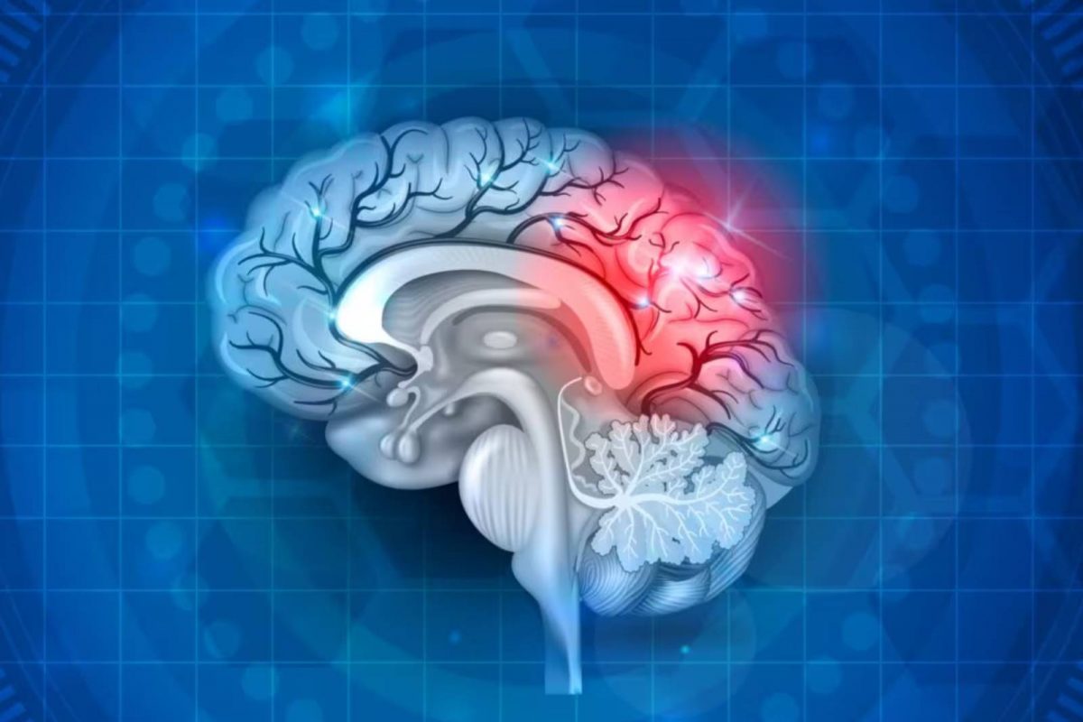 Health Tips | ബ്രെയിൻ സ്ട്രോക്ക്: ലക്ഷണങ്ങൾ എന്തൊക്കെ? ചികിത്സ എങ്ങനെ?
