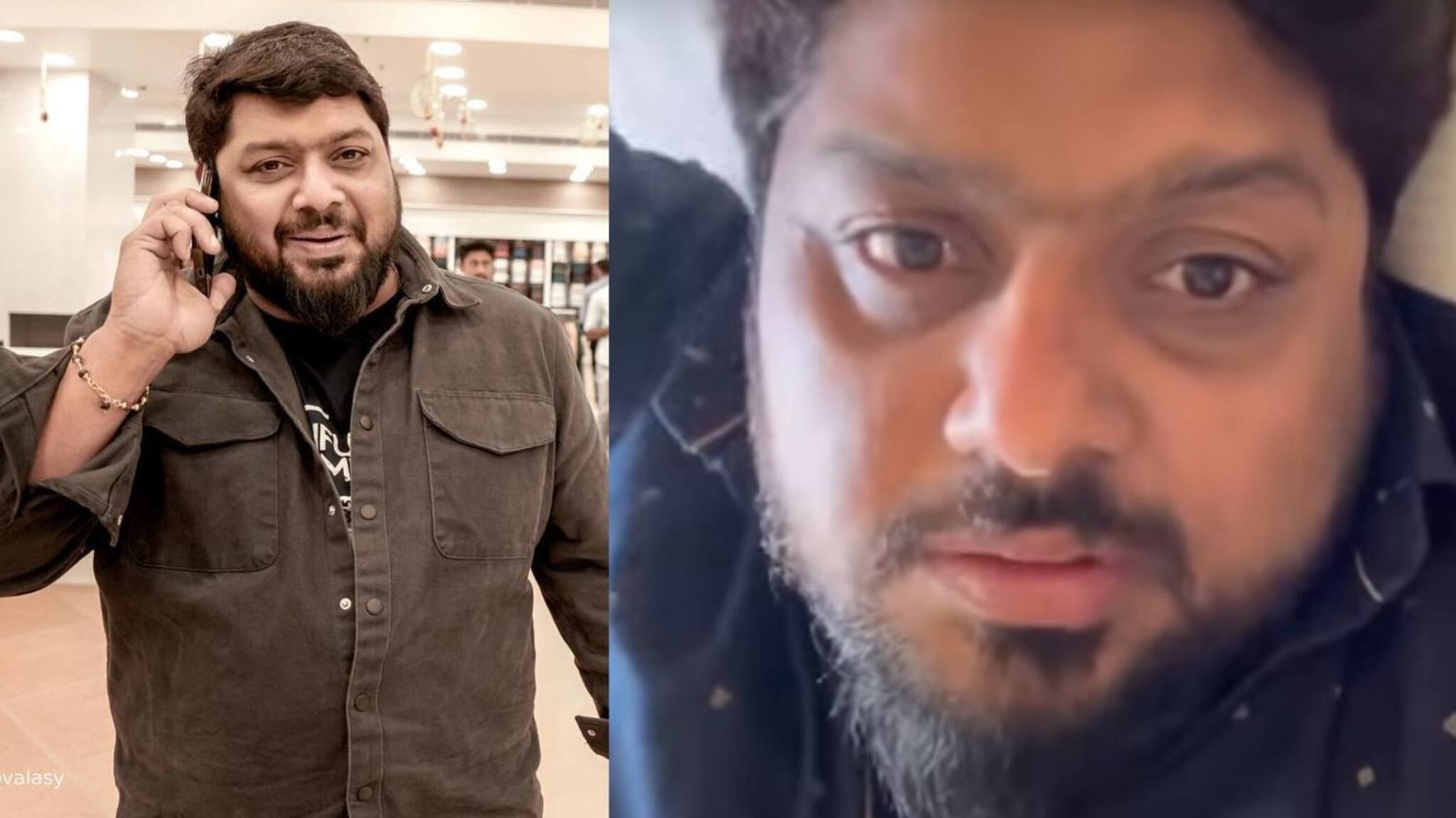 Bell's Palsy| ബെൽസ് പാൾസി; നടൻ മിഥുൻ രമേശ് ആശുപത്രിയില്‍