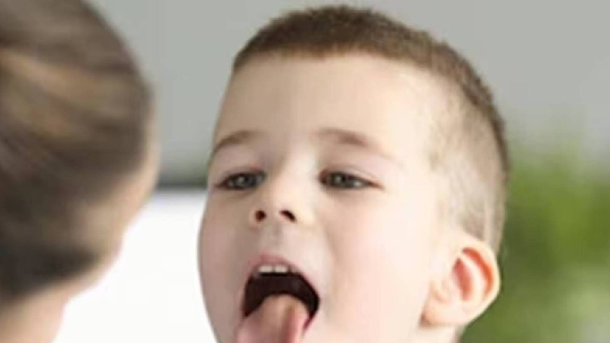 Health Tips | എന്താണ് അഡിനോയ്ഡൈറ്റിസ്? ഈ രോ​ഗം എങ്ങനെയാണ് ഉണ്ടാകുന്നത്?