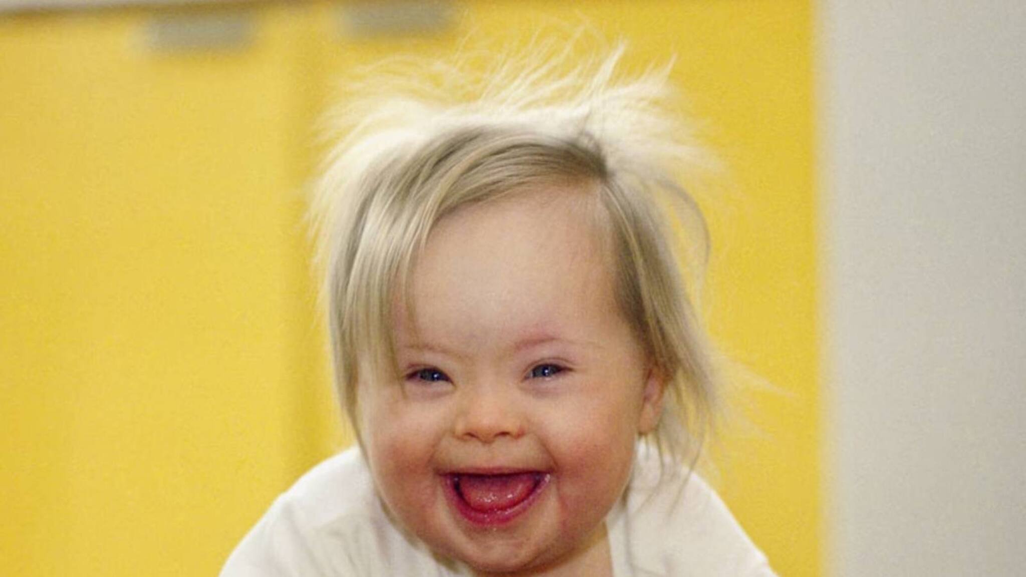 Health Tips | എന്താണ് ഡൗൺ സിൻഡ്രോം? മാതാപിതാക്കൾക്ക് എന്തൊക്കെ മുൻകരുതലുകളെടുക്കാം?