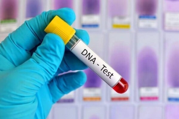 DNA ടെസ്റ്റിൽ കമ്പനിയിലെ മേലുദ്യോഗസ്ഥൻ അർദ്ധ സഹോദരൻ എന്ന് തെളിഞ്ഞു; യുവതിക്ക് ജോലി നഷ്‌ടമായി