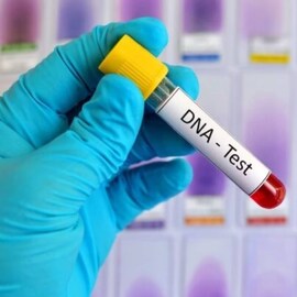 DNA ടെസ്റ്റിൽ കമ്പനിയിലെ മേലുദ്യോഗസ്ഥൻ അർദ്ധ സഹോദരൻ എന്ന് തെളിഞ്ഞു; യുവതിക്ക് ജോലി നഷ്‌ടമായി
