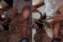 കോവളം ബീച്ച് കാണാനെത്തിയ 10 വയസുകാരിയുടെ കാല്‍ സ്ലാബിനിടയില്‍ കുടുങ്ങി