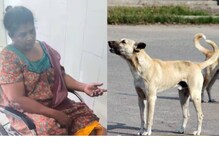 തൃശൂരില്‍ തെരുവുനായ കടിച്ച് വീട്ടമ്മയ്ക്ക് ഗുരുതര പരുക്ക്; തെരുവുനായക്ക് പേവിഷബാധയുള്ളതായി സംശയം
