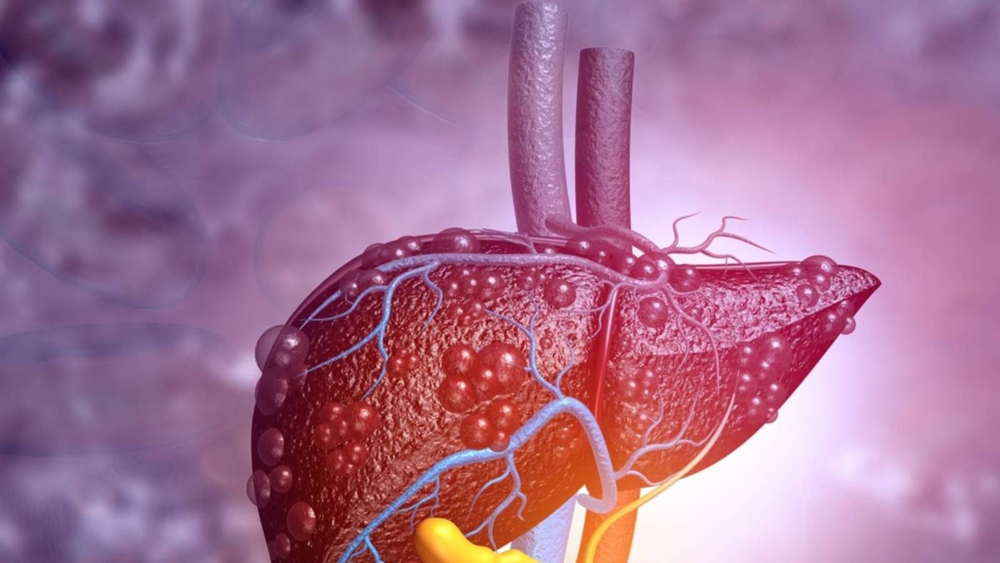 Health Tips | കുട്ടികളിലെ വൈറൽ ഹെപ്പറ്റൈറ്റിസ്: ലക്ഷണങ്ങൾ എന്തെല്ലാം? ഭയക്കേണ്ടതുണ്ടോ?