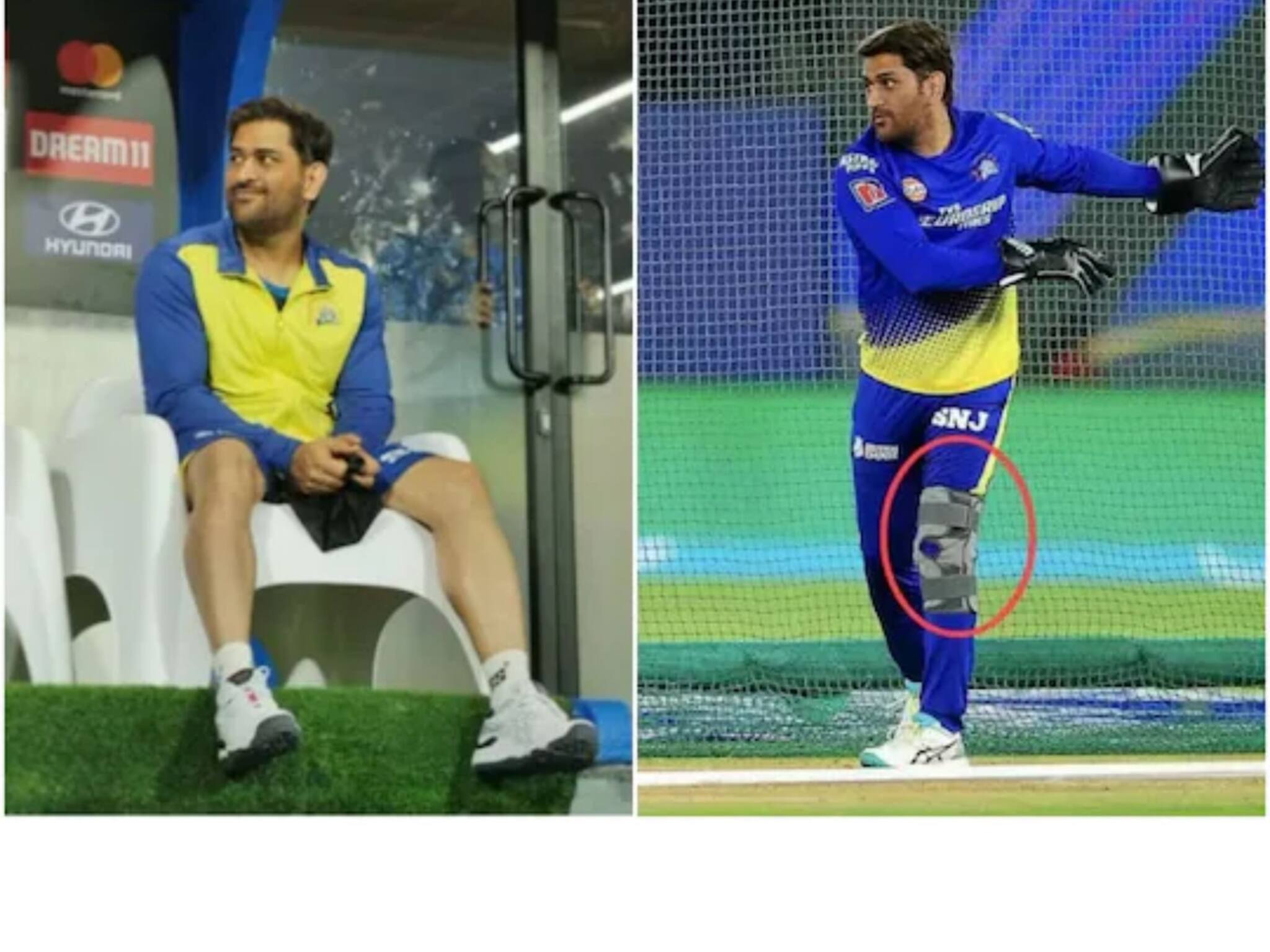 MS Dhoni|  ധോണി ഇനി ഓടാൻ ബുദ്ധിമുട്ടില്ല;കാൽമുട്ട് ശസ്ത്രക്രിയ വിജയകരം