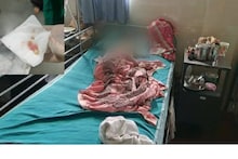 മൂക്കിനുള്ളിലെ ദശ നീക്കാനുള്ള ശസ്ത്രക്രിയയ്ക്കിടെ ആറു വയസ്സുകാരിയുടെ പല്ലുകൾ പറിച്ചെന്ന് പരാതി