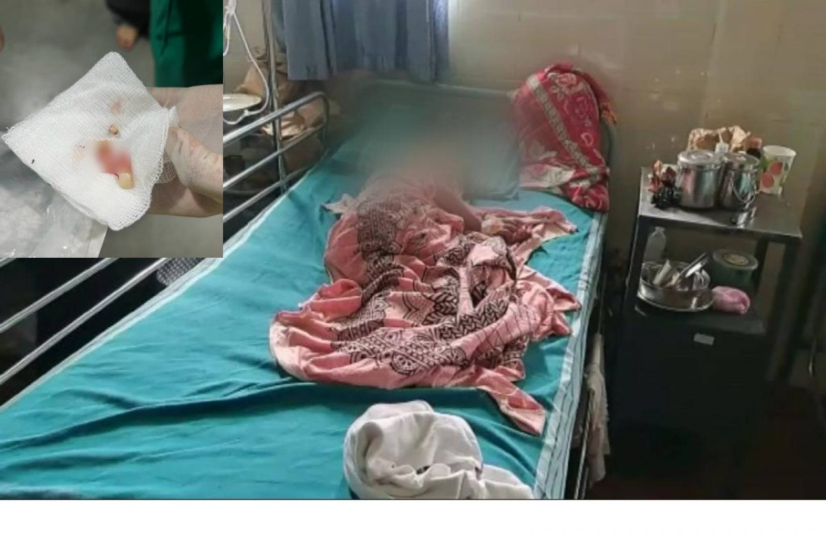 മൂക്കിനുള്ളിലെ ദശ നീക്കാനുള്ള ശസ്ത്രക്രിയയ്ക്കിടെ ആറു വയസ്സുകാരിയുടെ പല്ലുകൾ പറിച്ചെന്ന് പരാതി