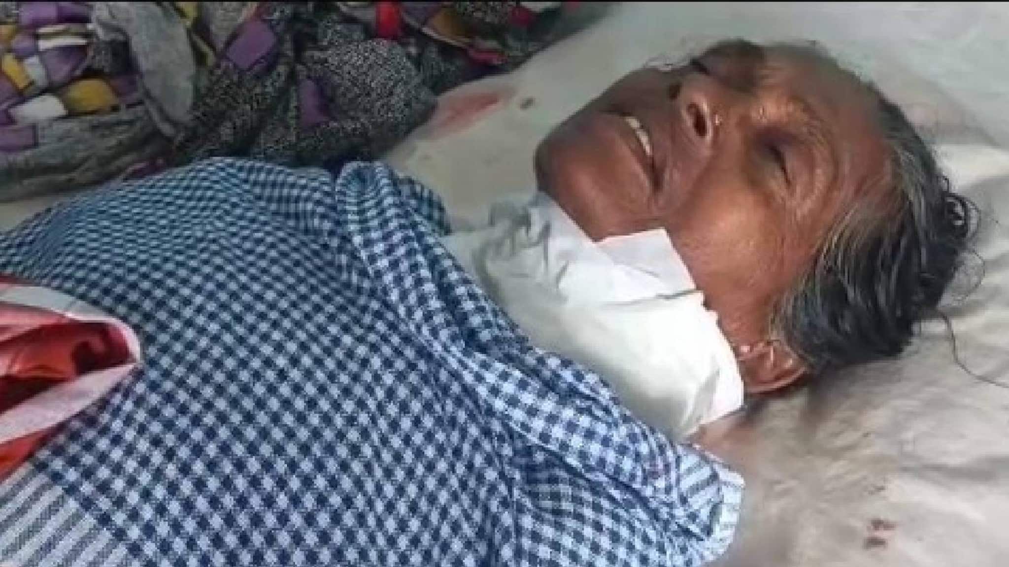 കാസർഗോഡ് തെരുവുനായ അക്രമണത്തിൽ വയോധികയ്ക്ക് ഗുരുതര പരിക്ക് കാസർഗോഡ് തെരുവുനായ അക്രമണത്തിൽ വയോധികയ്ക്ക് ഗുരുതര പരിക്ക്