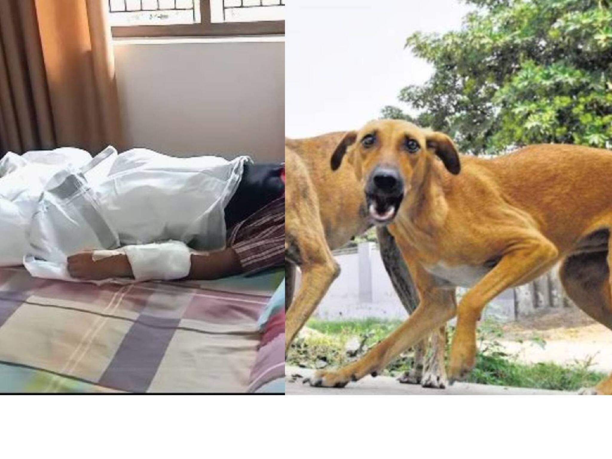 കണ്ണൂരില്‍ സ്കൂൾ വിട്ടു മടങ്ങിയ 5-ാം ക്ലാസുകാരനെ തെരുവുനായ കടിച്ചു; വലതു കൈക്കും കാലിനും ഗുരുതര പരിക്ക്