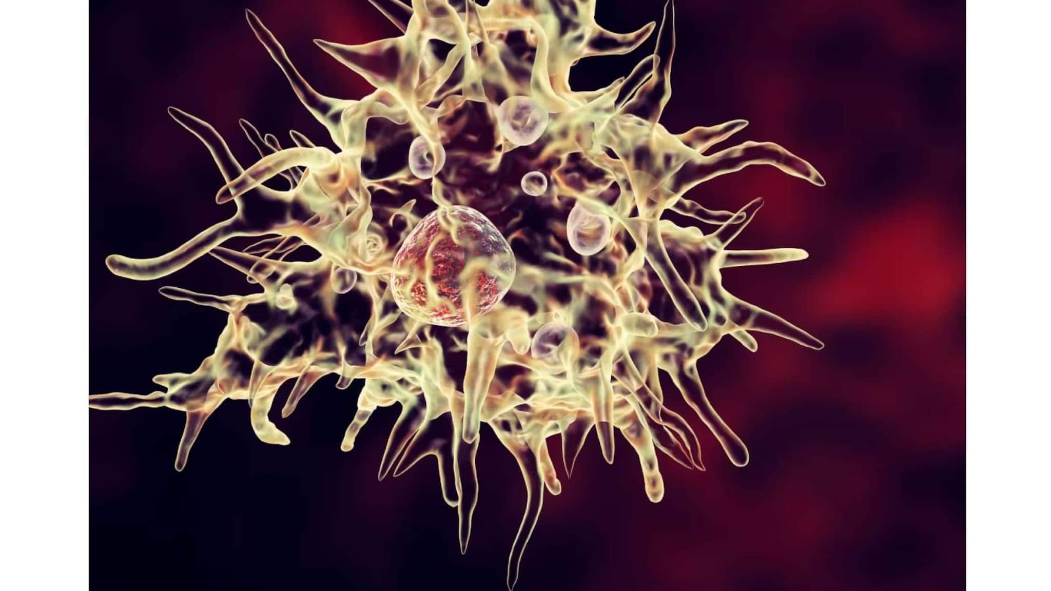 തലച്ചോറിനെ കാർന്നു തിന്നുന്ന 'ബ്രെയിൻ ഈറ്റിങ് അമീബിയ'; മലിന ജലത്തിലൂടെ ശരീരത്തിലെത്തുന്ന അമീബ