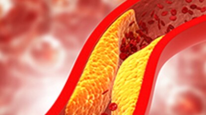 കൊളസ്ട്രോൾ കൊളസ്ട്രോൾ