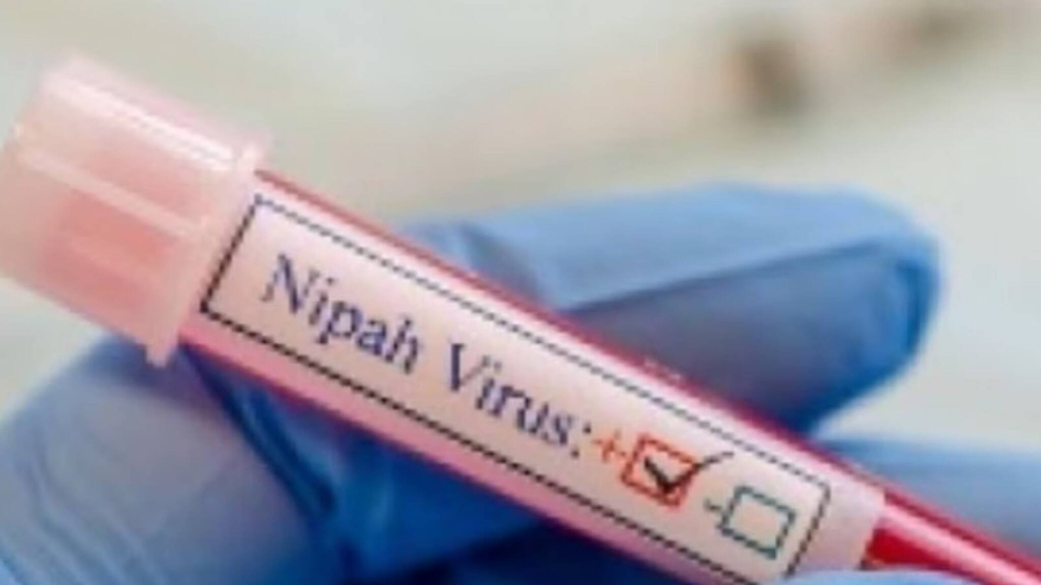 നിപ വൈറസിനെതിരെ മനുഷ്യരില്‍ ആദ്യമായി വാക്‌സിന്‍ പരീക്ഷണം ആരംഭിച്ച് ഓക്‌സ്‌ഫോര്‍ഡ് ഗവേഷകര്‍