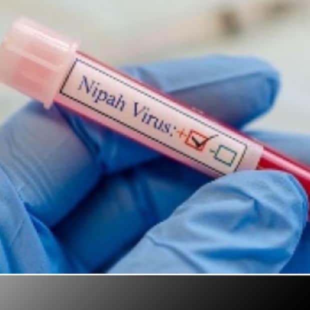Nipah_Virus