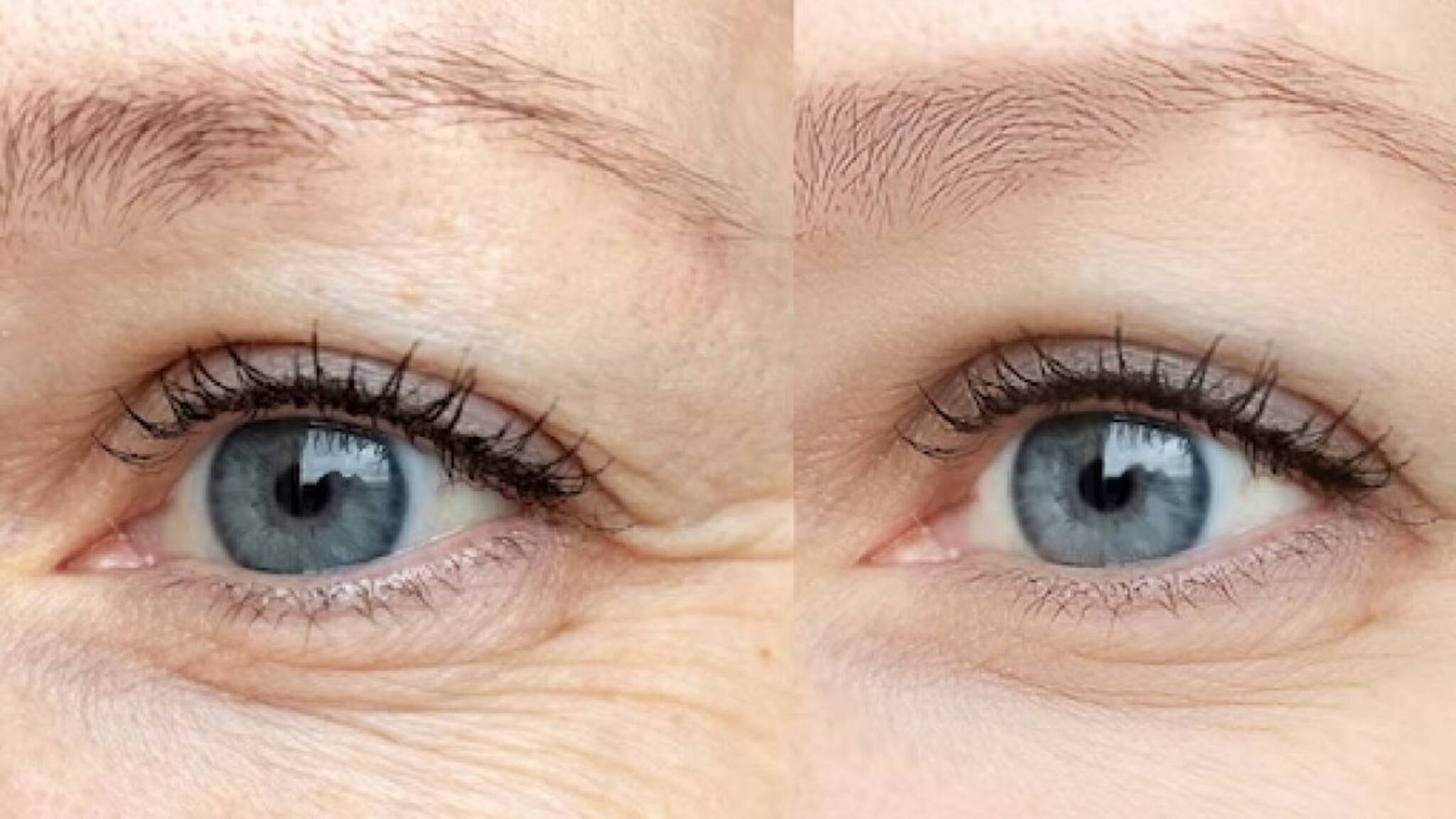 ആന്റി ഏജിങ്ങിന് ഹൈഡ്രജൻ തെറാപ്പി ബെസ്റ്റാ; ശാസ്ത്രജ്ഞർ പറയുന്നതെന്ത്?