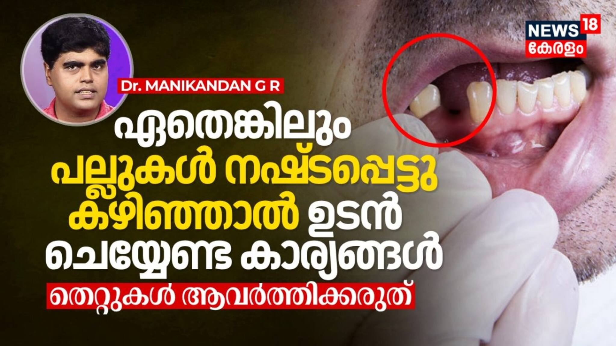 Dr. Q | ഏതെങ്കിലും പല്ലുകൾ നഷ്ടപ്പെട്ടു കഴിഞ്ഞാൽ ഉടൻ ചെയ്യേണ്ട കാര്യങ്ങൾ, തെറ്റുകൾ ആവർത്തിക്കരുത്