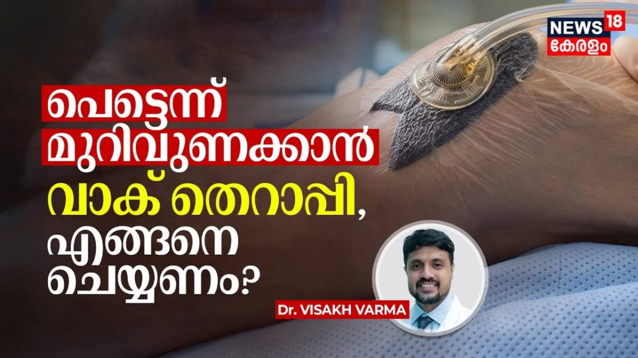 പെട്ടെന്ന് മുറിവുണക്കാൻ വാക് തെറാപ്പി, എങ്ങനെ ചെയ്യണം? Vacuum Assisted Closure Therapy